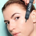 Acne Intense Blemish & Pore Treatment - 20 ml
