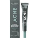 Acne Intense Blemish & Pore Treatment - 20 ml