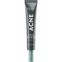 Acne Intense Blemish & Pore Treatment - 20 ml