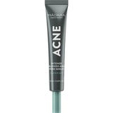 Acne Intense Blemish & Pore Treatment