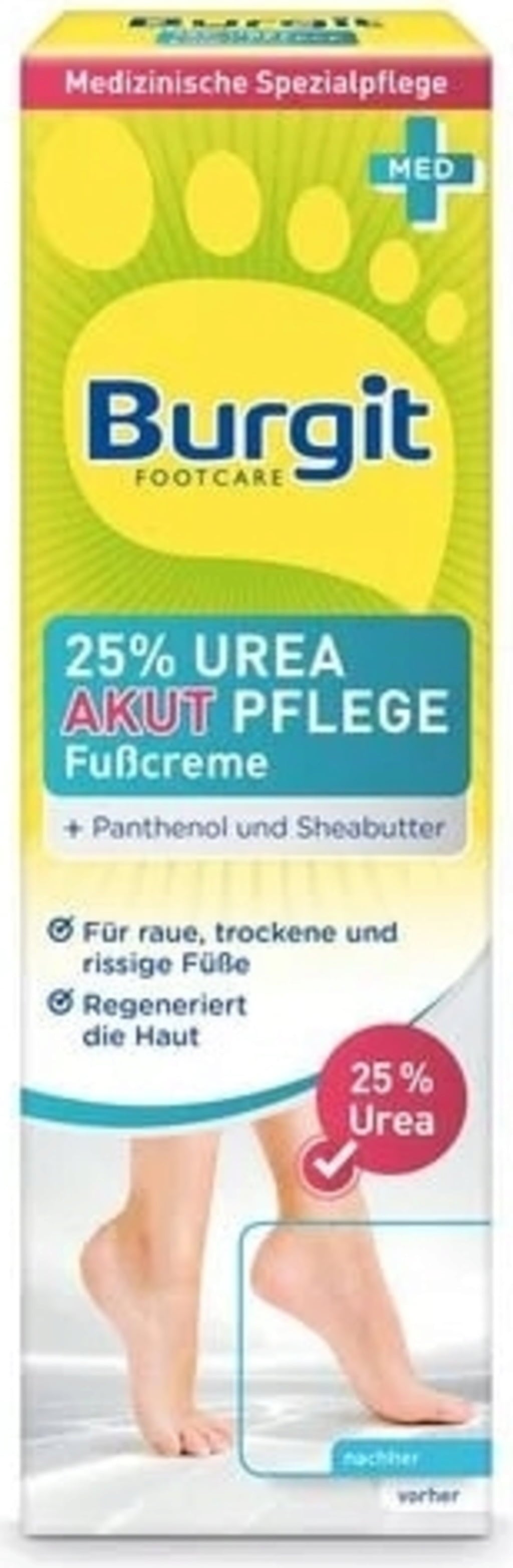 Burgit Urea Acute Care Foot Cream - 75 ml