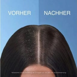 Head & Shoulders Haarshampoo 2in1 apple fresh - 250 ml