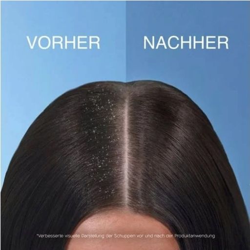 Head & Shoulders Haarshampoo Anti-Schuppen Tiefenpflege - 300 ml